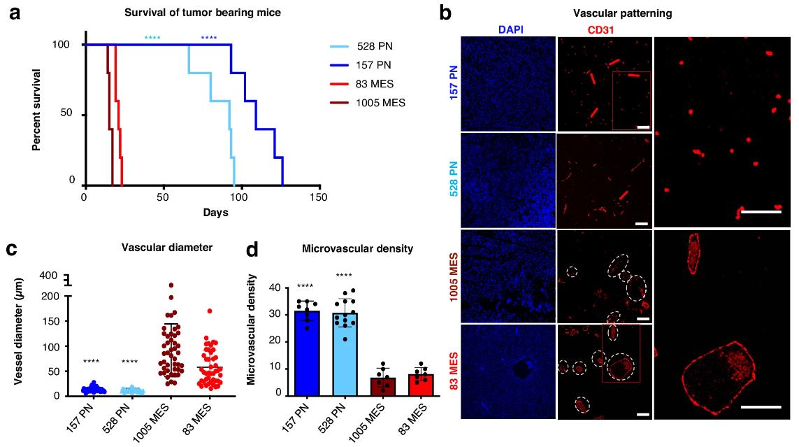 Figure 1. Distinct vascular patterns in GSC-driven tumors and vasoactivity of soluble and vesicular components of the glioma stem cell secretome.