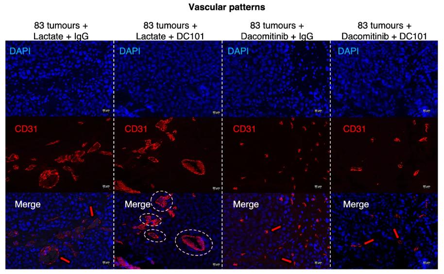 Figure 2. Combined targeting of VEGFR2 and EGFR suppresses tumour growth and vasectasia.