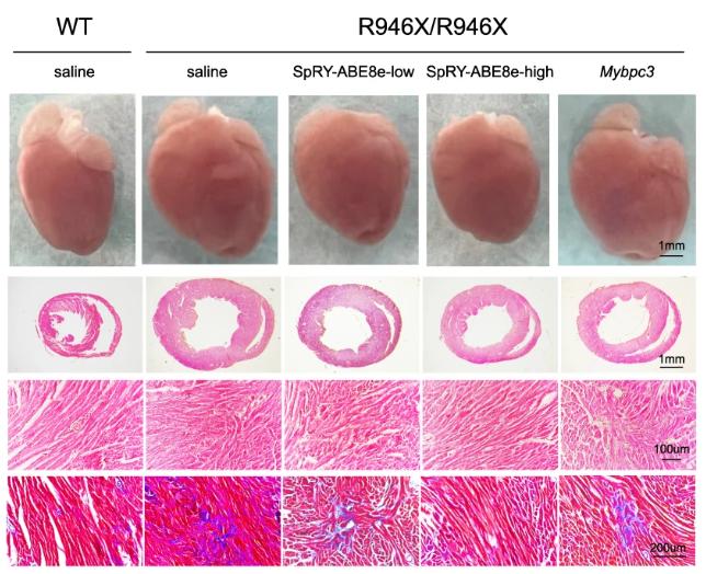 Figure 2. Representative anatomic images of AAV-SpRY-ABE8e- and AAV-Mybpc3-treated hearts 6 months post-injection.