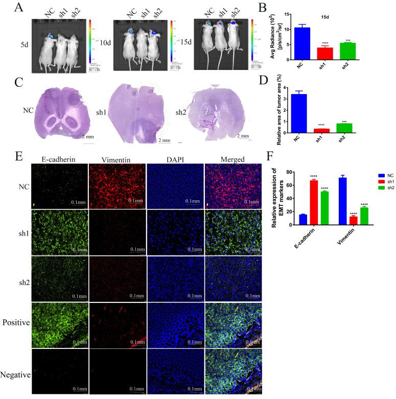 Figure 1. Effects of knockdown of SECTM1 in U87 MG on in situ tumorigenesis in mice. (Yao Z, et al., 2024)