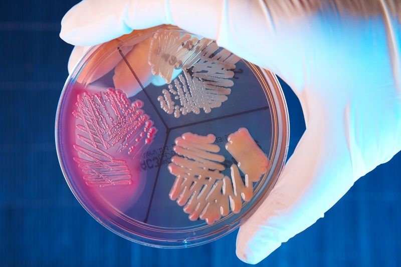 Microbial Genome Editing Services