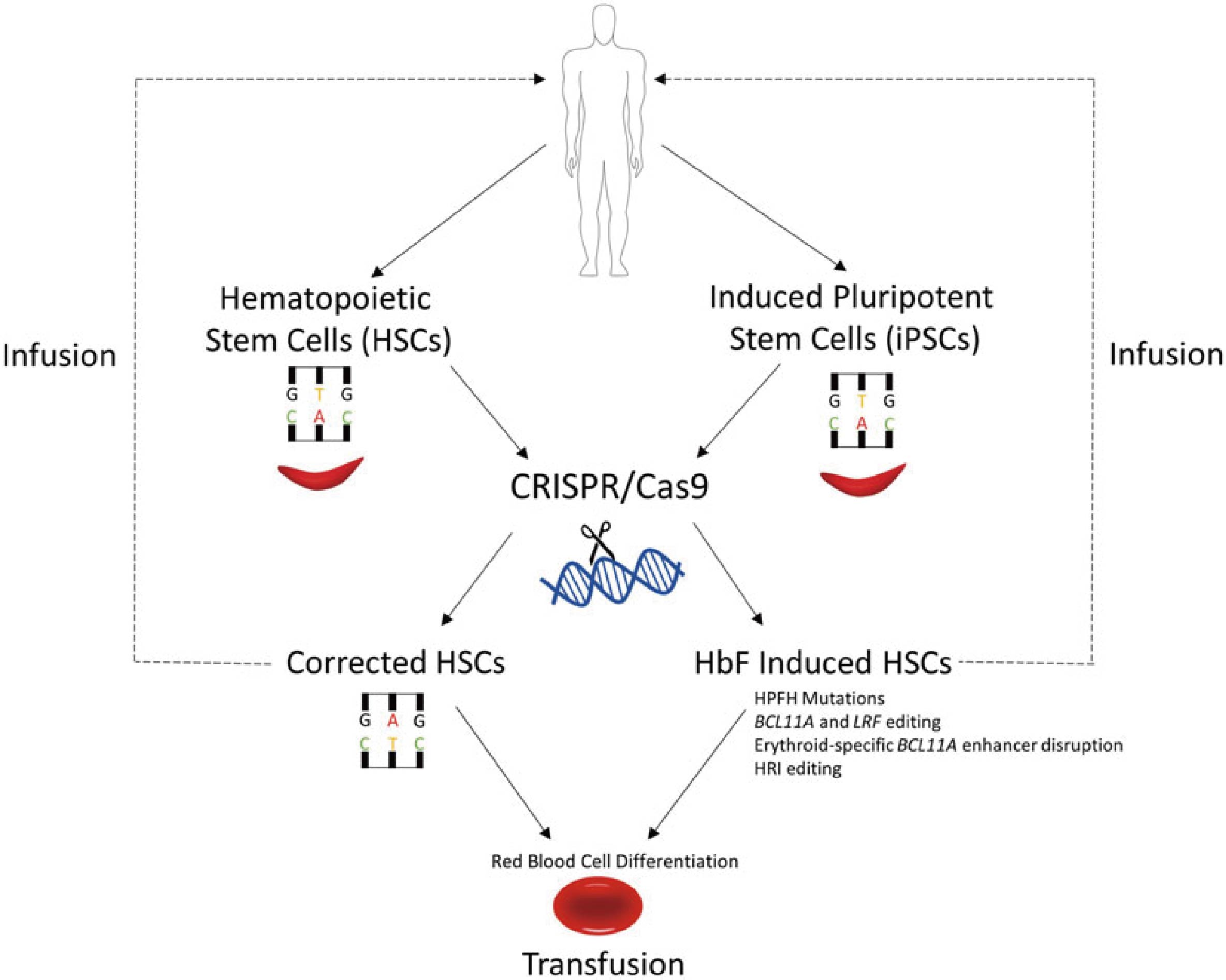 CRISPR-Cas9 Genome Editing for Treating Sickle Cell Disease