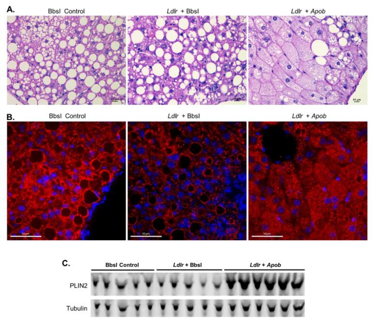 Concomitant disruption of Ldlr and Apob results in microvesicular steatosis.