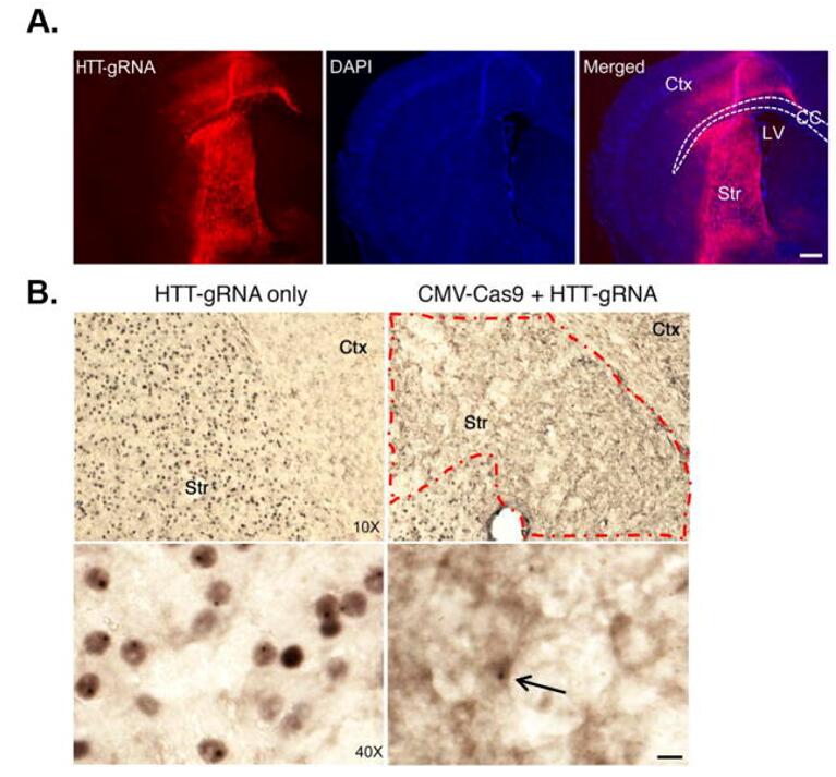 CRISPR/Cas9 gene editing reduces pathology in a mouse model of Huntington's disease.