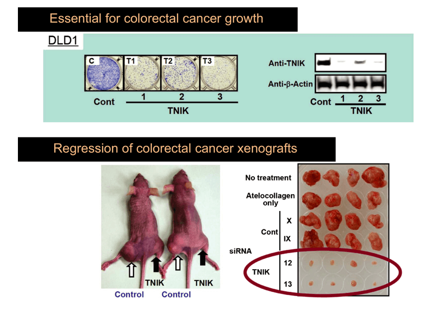 TNIK is essential for colorectal cancer growth.