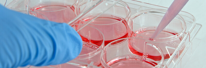Gene Overexpression Stable Cell Lines