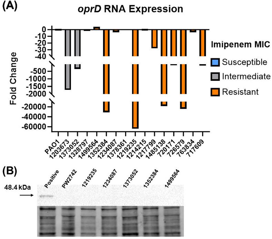 Figure 2 demonstrates that decreased oprD transcript levels and protein production are associated with imipenem non-susceptibility in Pseudomonas aeruginosa isolates, as shown by qRT-PCR and western blot analysis. (doi: 10.1128/spectrum.00142-24)